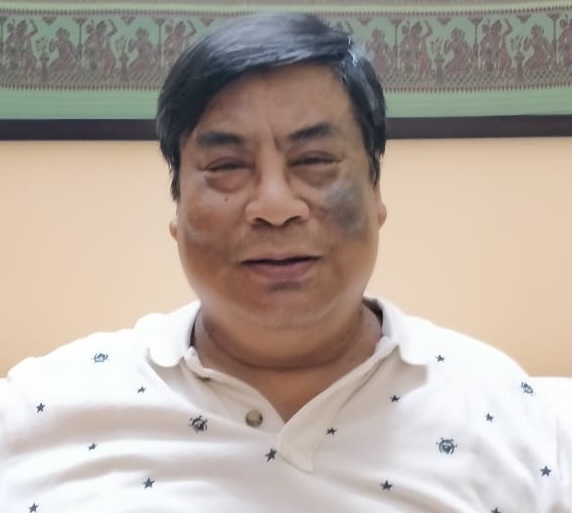 K P Brahma
